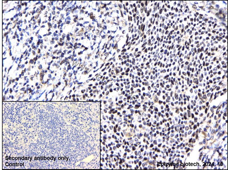 Anti-p95/NBS1 Rabbit mAb [36T47K65]