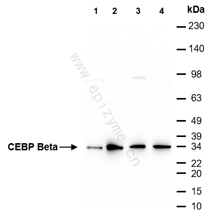 Anti-CEBP Beta Rabbit mAb [45B53Q53]