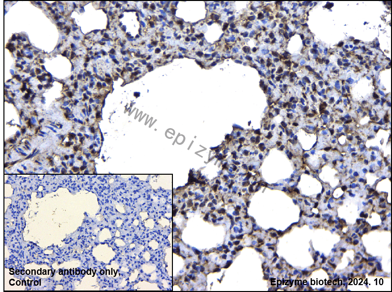 Anti-CEBP Beta Rabbit mAb [45B53Q53]