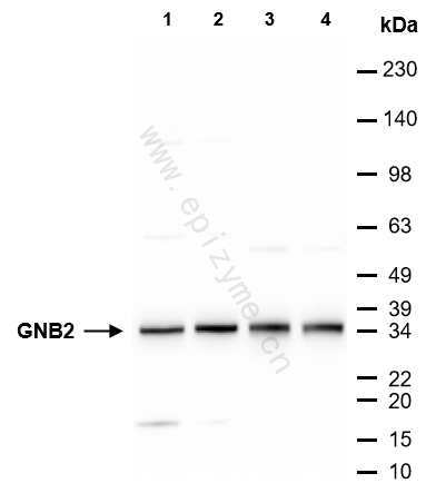 Anti-GNB2 Rabbit mAb [17I18S83]