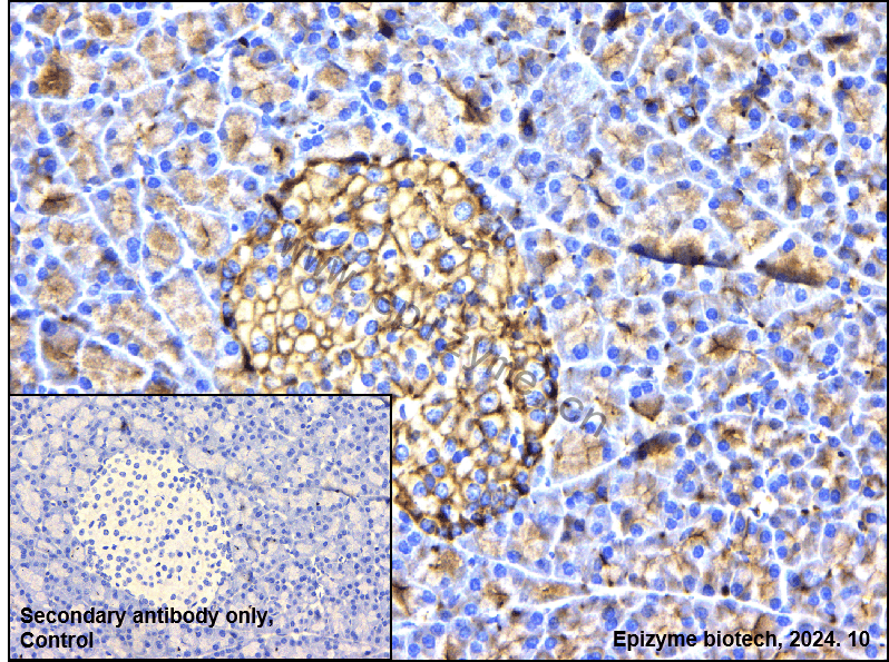 Anti-GNB2 Rabbit mAb [17I18S83]