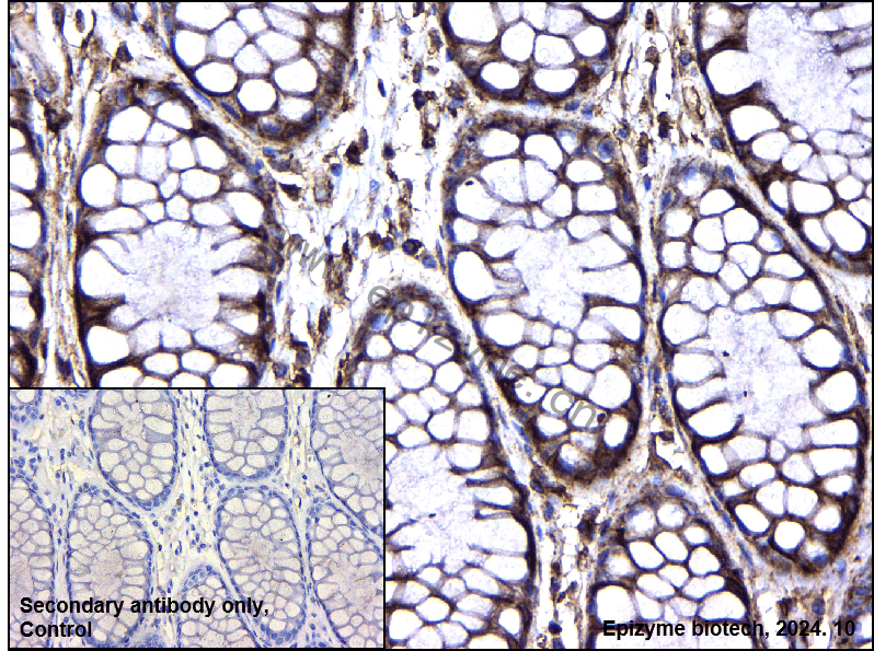 Anti-GNB2 Rabbit mAb [17I18S83]