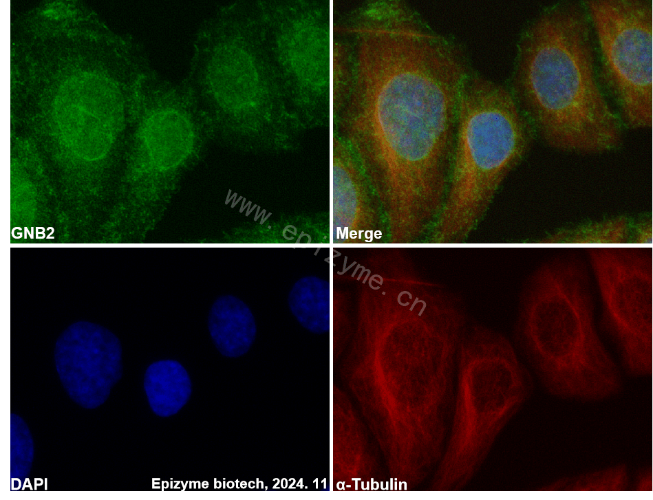 Anti-GNB2 Rabbit mAb [17I18S83]