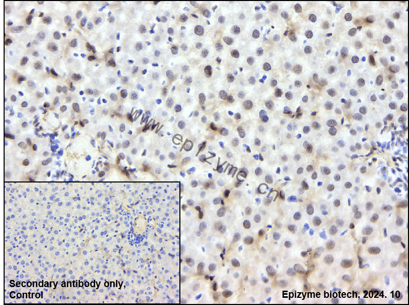 Anti-ZHX2 Rabbit mAb [23N75D09]