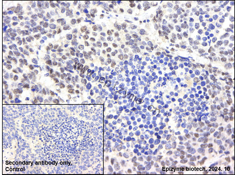Anti-ZHX2 Rabbit mAb [23N75D09]