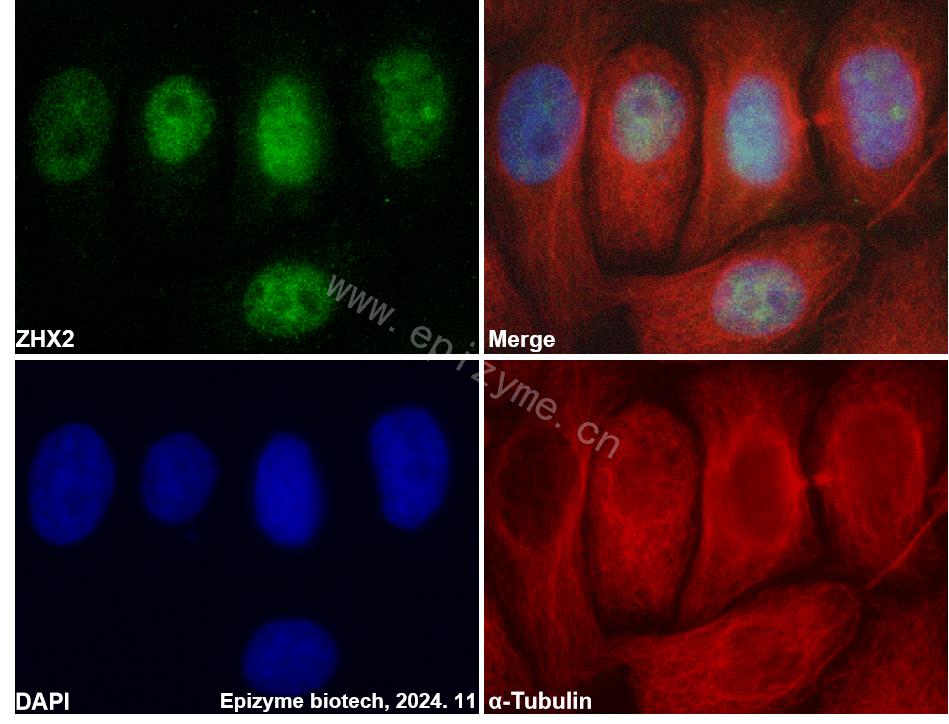 Anti-ZHX2 Rabbit mAb [23N75D09]