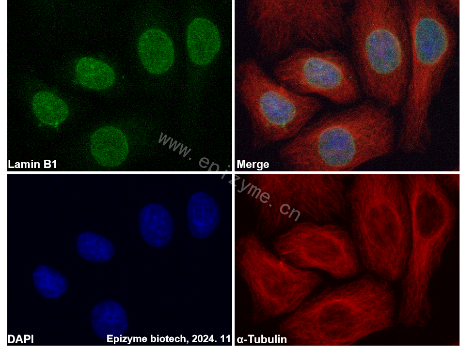 Anti-Lamin B1 Rabbit mAb [54I84Q27]