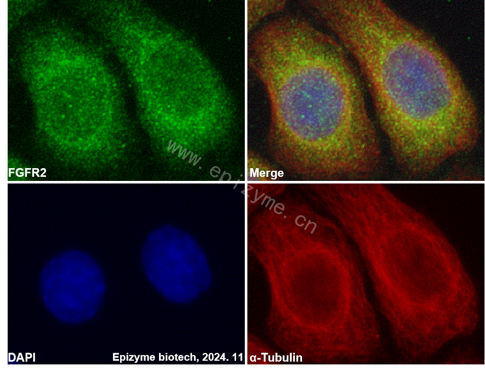 Anti-FGFR2 Rabbit mAb [30N36N11]