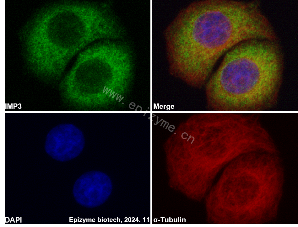 Anti-IMP3 Rabbit mAb [20E34Q45]