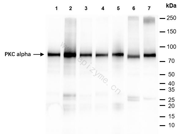 Anti-PKC alpha Rabbit mAb [57T02F67]