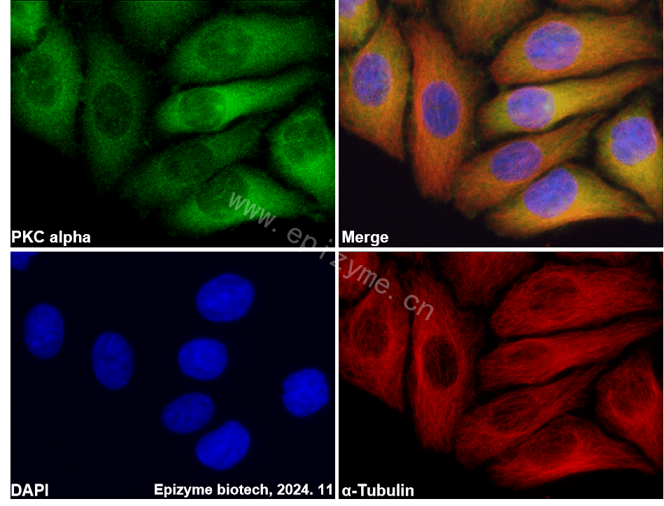 Anti-PKC alpha Rabbit mAb [57T02F67]
