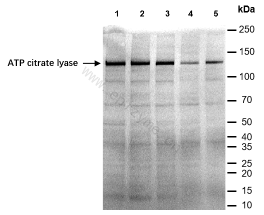 Anti-ATP citrate lyase Rabbit mAb [66B75C05]