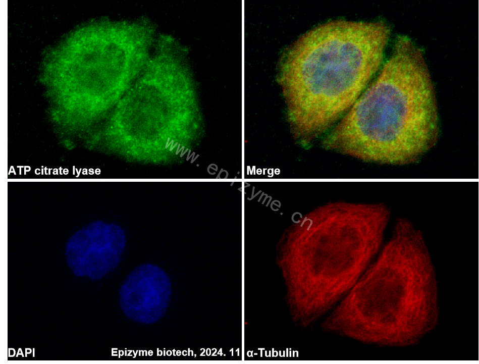 Anti-ATP citrate lyase Rabbit mAb [66B75C05]