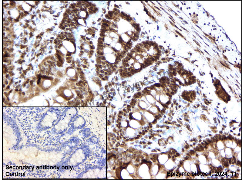 Anti-Skp1 Rabbit mAb [55C19N75]