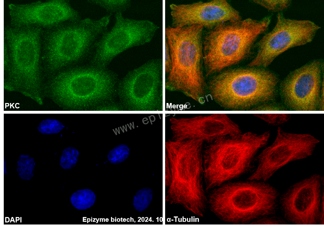 Anti-PKC Rabbit mAb [21R58J41]