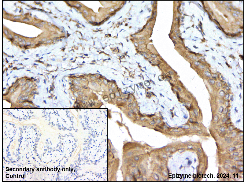 Anti-PKC Rabbit mAb [21R58J41]