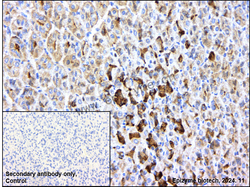 Anti-PKC Rabbit mAb [21R58J41]
