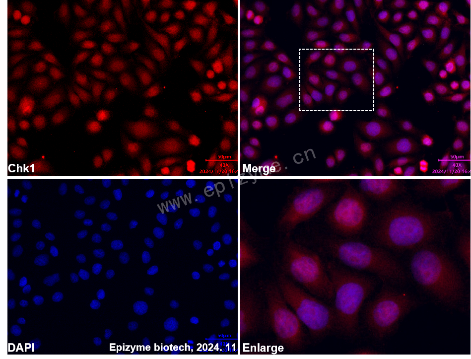 Anti-Chk1 Rabbit mAb [13M12E38]