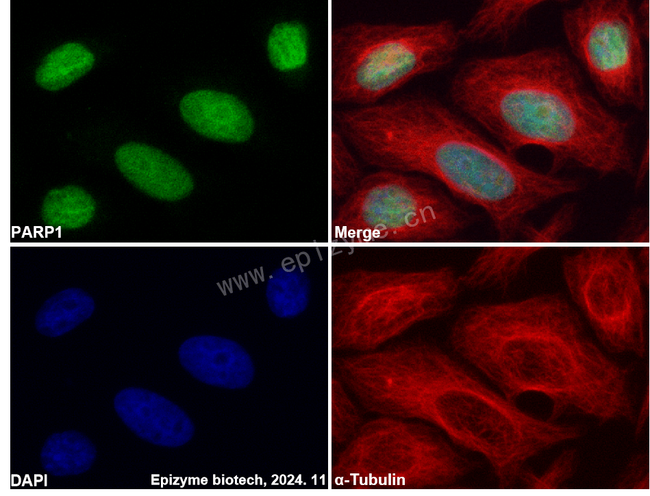 Anti-PARP1 Rabbit mAb [76M33M81]