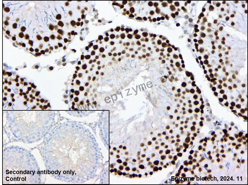 Anti-PARP1 Rabbit mAb [76M33M81]