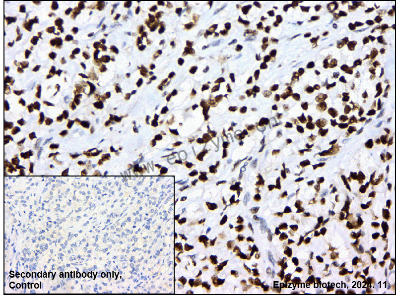 Anti-PARP1 Rabbit mAb [76M33M81]