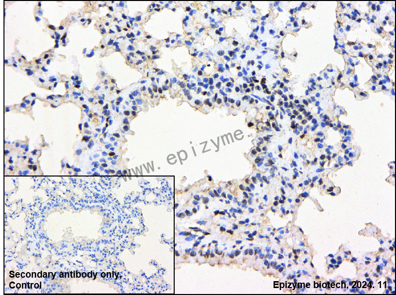 Anti-PARP1 Rabbit mAb [76M33M81]
