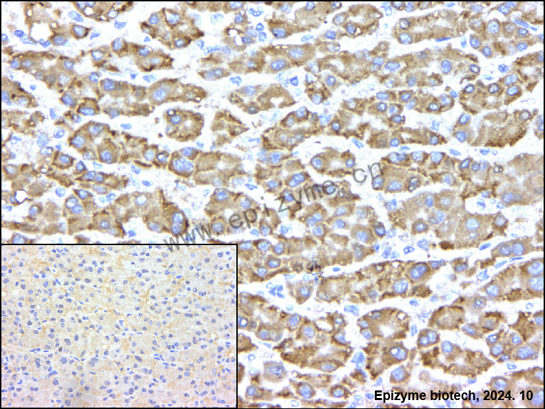 Anti-GCLM Rabbit mAb [97Q92C74]