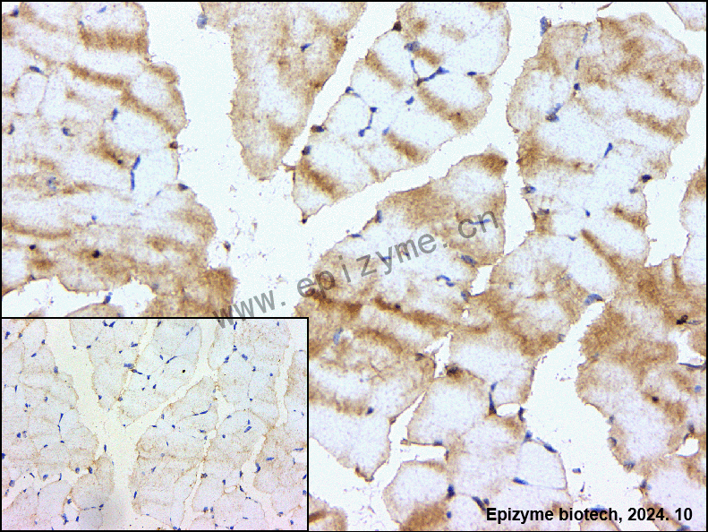 Anti-GCLM Rabbit mAb [97Q92C74]