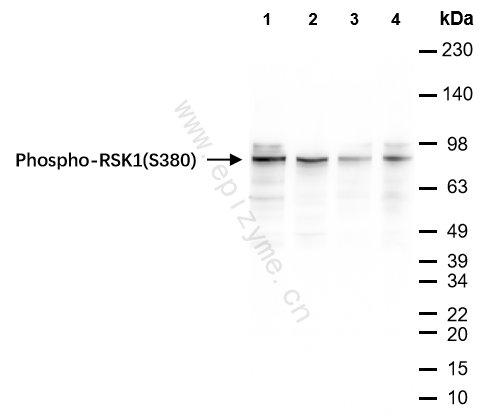 Anti-Phospho-RSK1 (Ser380) Rabbit mAb [72J08F97]