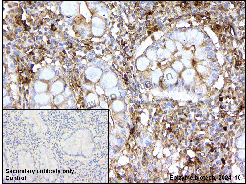 Anti-Phospho-RSK1 (Ser380) Rabbit mAb [72J08F97]