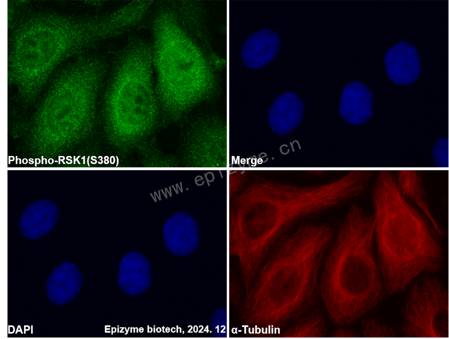 Anti-Phospho-RSK1 (Ser380) Rabbit mAb [72J08F97]