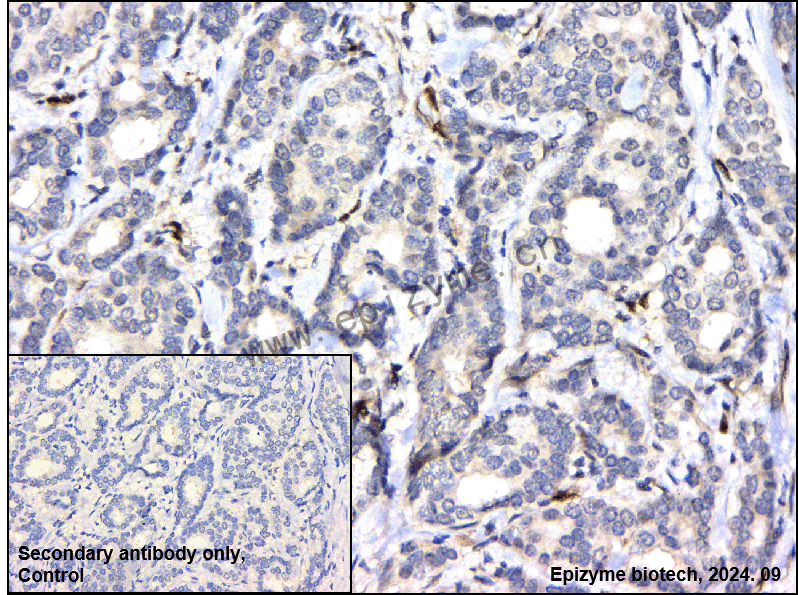 Anti-Phospho-ATF2 (Thr71) Rabbit mAb [41G81H46]