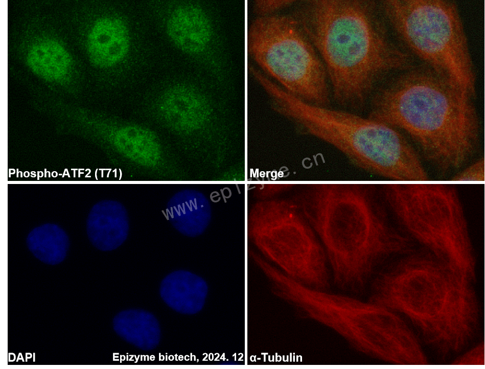 Anti-Phospho-ATF2 (Thr71) Rabbit mAb [41G81H46]