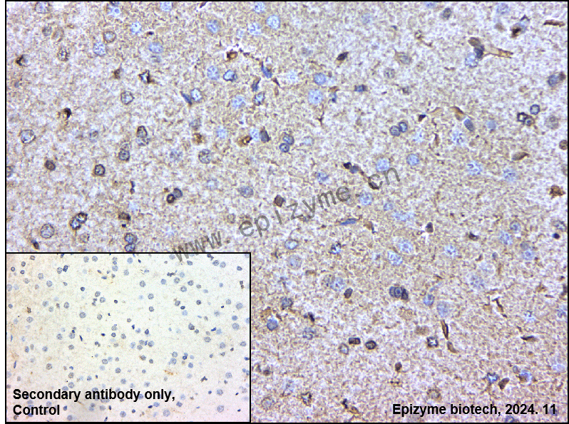 Anti-Histone H3 (acetyl Lys18) Rabbit mAb [52K62G34]