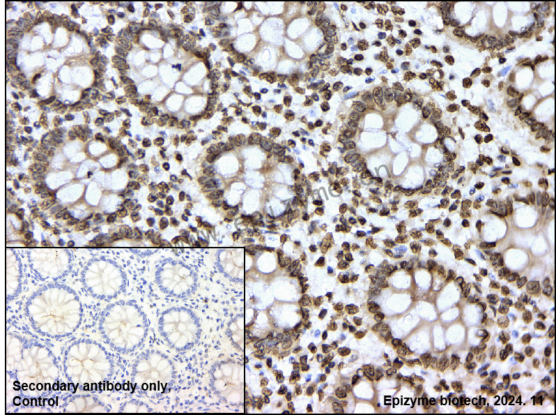 Anti-Histone H3 (acetyl Lys18) Rabbit mAb [52K62G34]