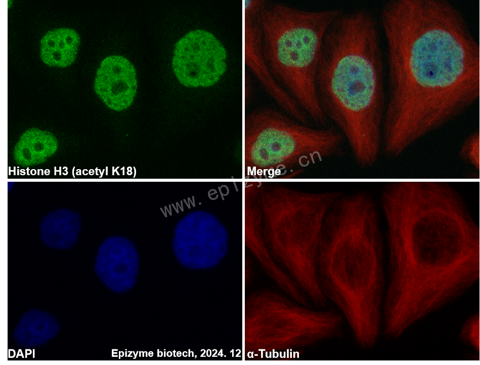 Anti-Histone H3 (acetyl Lys18) Rabbit mAb [52K62G34]