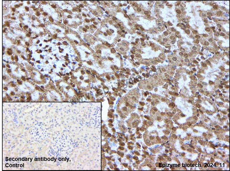 Anti-Histone H3 (acetyl Lys27) Rabbit mAb [57F78H70]