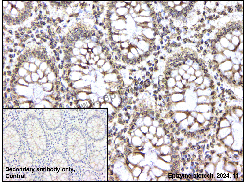 Anti-Histone H3 (acetyl Lys27) Rabbit mAb [57F78H70]