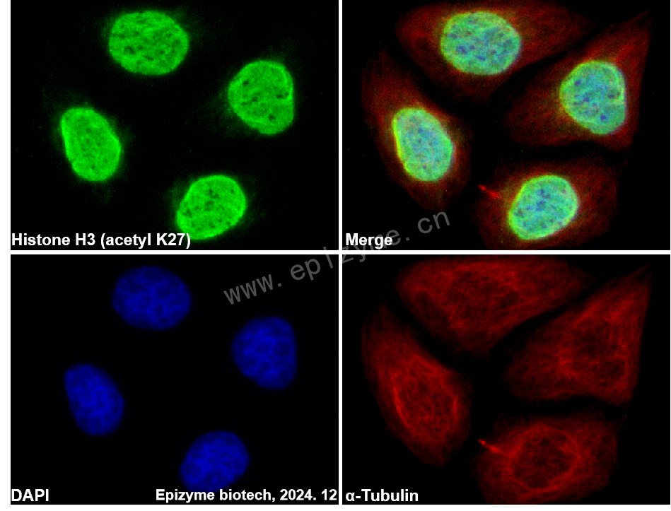 Anti-Histone H3 (acetyl Lys27) Rabbit mAb [57F78H70]