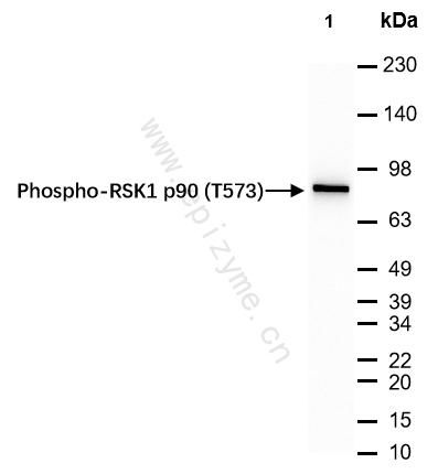 Anti-Phospho-RSK1 p90 (Thr573) Rabbit mAb [61S50L72]