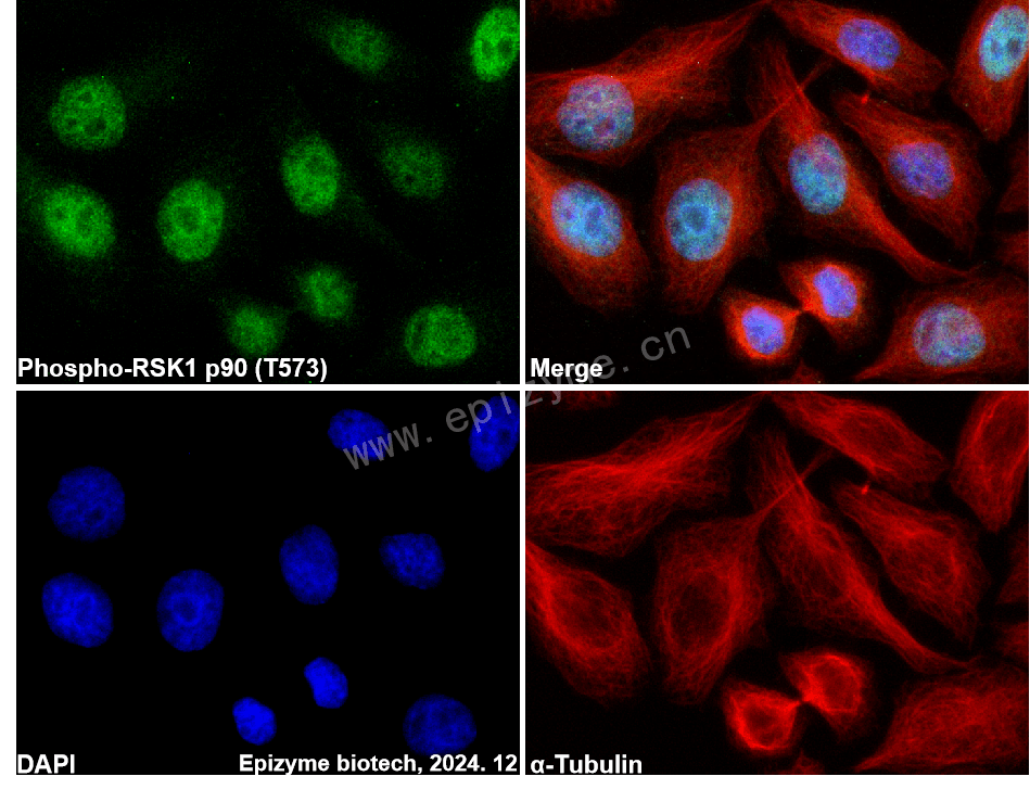 Anti-Phospho-RSK1 p90 (Thr573) Rabbit mAb [61S50L72]
