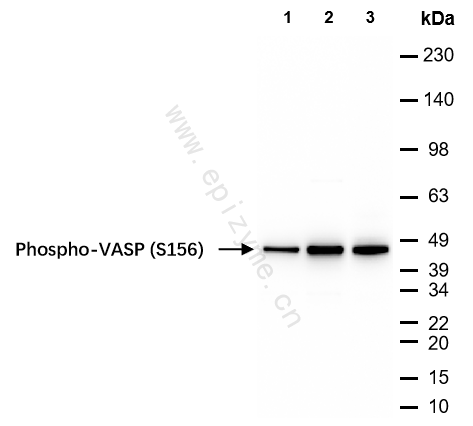 Anti-Phospho-VASP (Ser156) Rabbit mAb [20D94Q11]