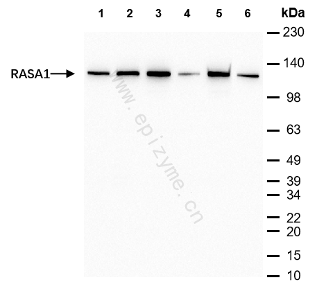 Anti-RASA1 Rabbit mAb [74R93E54]