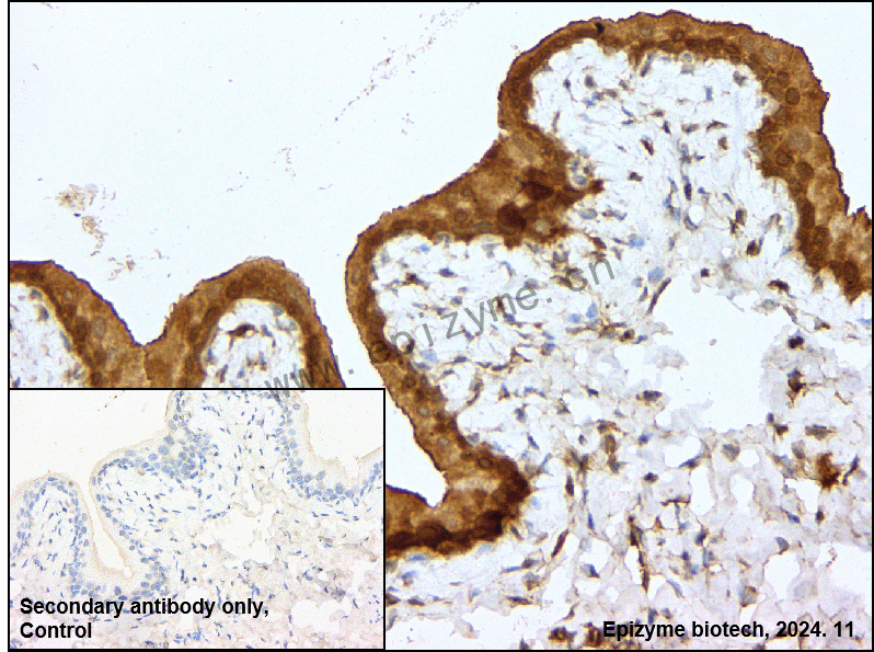Anti-RASA1 Rabbit mAb [74R93E54]