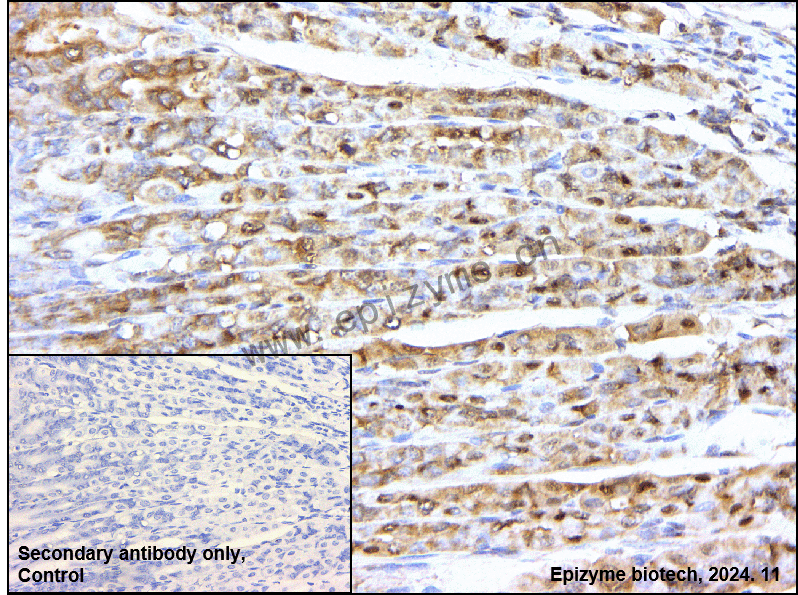 Anti-RASA1 Rabbit mAb [74R93E54]