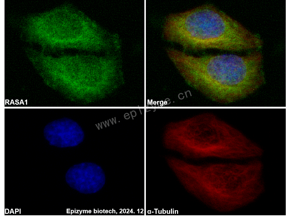 Anti-RASA1 Rabbit mAb [74R93E54]