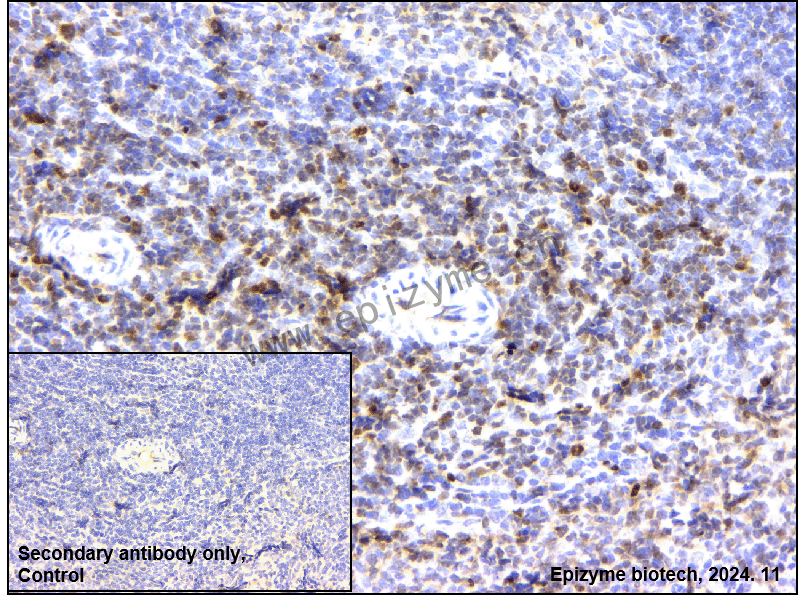 Anti-ETS1 Rabbit mAb [18M91H53]