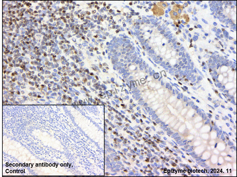 Anti-ETS1 Rabbit mAb [18M91H53]