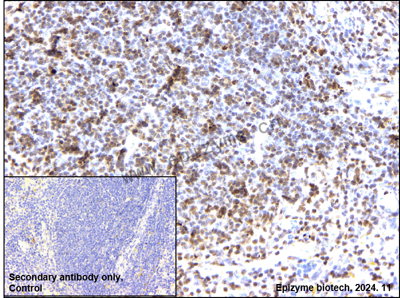 Anti-ETS1 Rabbit mAb [18M91H53]