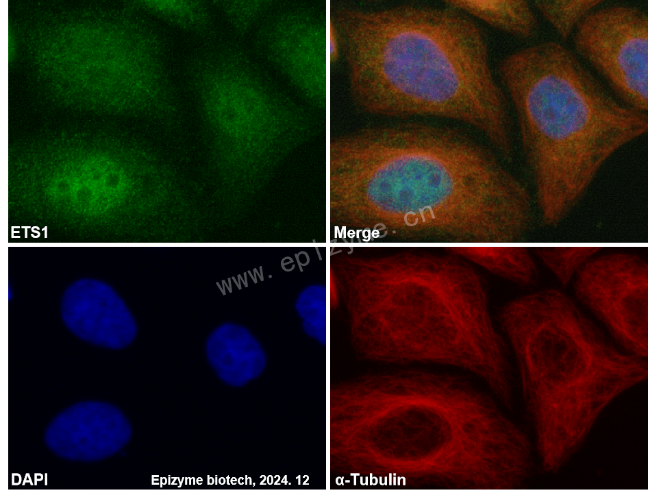 Anti-ETS1 Rabbit mAb [18M91H53]